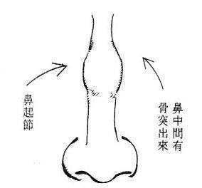 竹节鼻