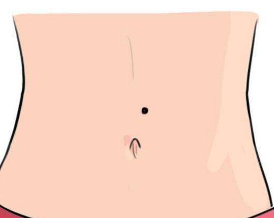 肚脐正中有痣代表什么？