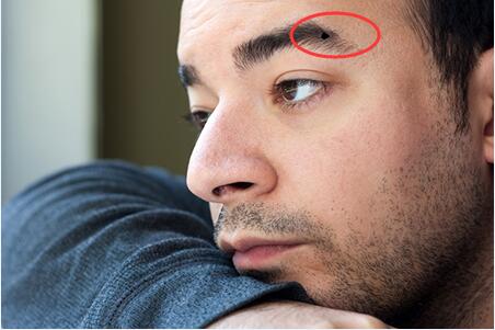 男性眉毛中长有痣有着怎样的特殊含义