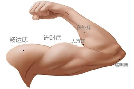 痣相分析：男手臂痣的位置与命运图