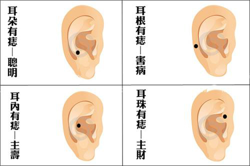 「女人耳朵上长痣」外耳轮长痣面相图 好的耳朵面相