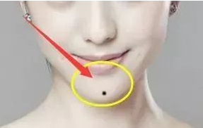 女人下颚长痣代表什么
