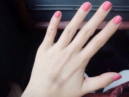 女人小指有痣代表什么