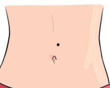 肚脐正中有痣代表什么