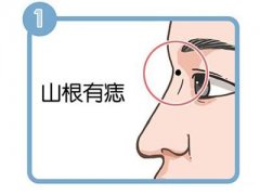 这四种鼻子上的痣，各自代表什么意义？是好还是坏？