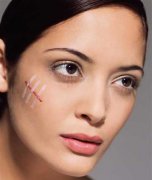 为你分析面部伤疤带来的影响？